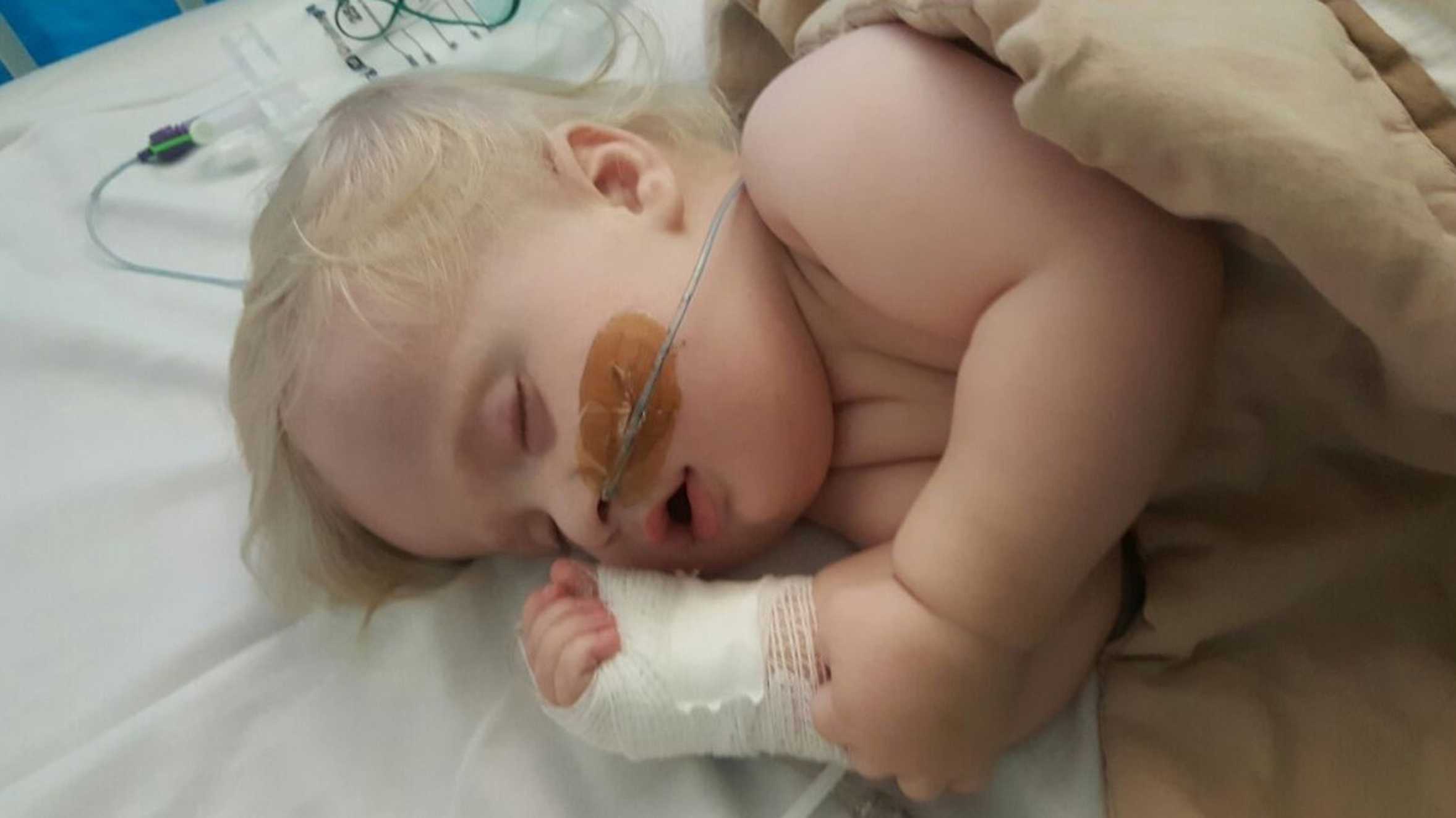 Close up of Ezra asleep in hospital with a bandaged arm and feeding tube.